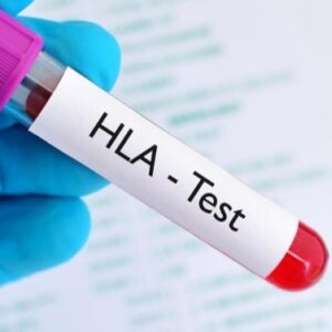 HLA Typing